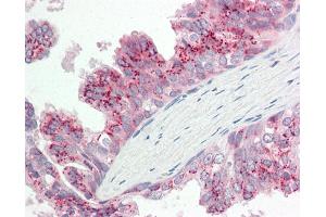 Human Prostate: Formalin-Fixed, Paraffin-Embedded (FFPE). (ATG4B Antikörper  (AA 110-159))