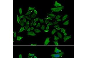 Immunofluorescence analysis of HeLa cells using ALAS1 Polyclonal Antibody (ALAS1 Antikörper)