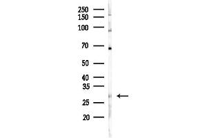 anti-Cell Division Cycle Associated 3 (CDCA3) (C-Term) antibody