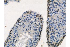 ABIN6256199 and ABIN6267172 at 1/100 staining Mouse testis tissue by IHC-P. (RPS6KA3 Antikörper  (pSer227))