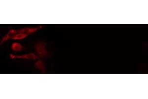 ABIN6277013 staining  HeLa cells by IF/ICC.