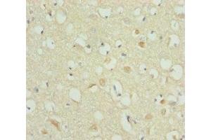 Immunohistochemistry of paraffin-embedded human brain tissue using ABIN7168273 at dilution of 1:100 (A2BP1 Antikörper  (AA 1-130))