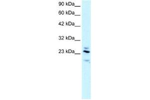 RGS20 antibody used at 2. (RGS20 Antikörper  (Middle Region))