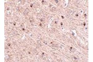 Immunohistochemistry of TOM70 in mouse brain tissue with this product at 2. (TOM70 Antikörper  (Center))
