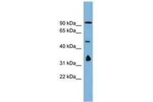 MAK10/NAA35 Antikörper  (AA 179-228)