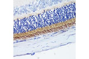 Immunohistochemistry of paraffin-embedded rat retina using PDE6B antibody (ABIN6132473, ABIN6145363, ABIN6145364 and ABIN6222688) at dilution of 1:200 (40x lens). (PDE6B Antikörper  (AA 1-190))