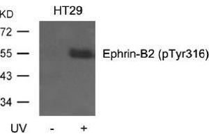 Western blot analysis of extracts from HT29 cells, untreated or treated with UV using Ephrin-B2 (Phospho-Tyr316). (Ephrin B2 Antikörper  (pTyr316))