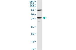Viral Entry Inhibition (VEI) image for anti-Pyruvate Dehydrogenase (Lipoamide) alpha 1 (PDHA1) (AA 1-390) antibody (ABIN518747)
