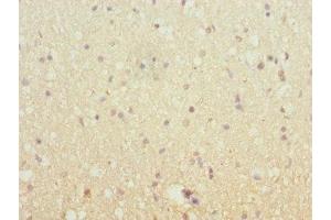 Immunohistochemistry of paraffin-embedded human brain tissue using ABIN7151640 at dilution of 1:100