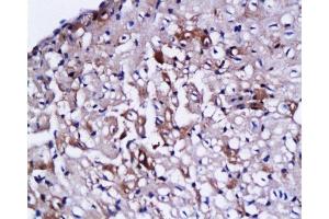 Immunohistochemistry (Paraffin-embedded Sections) (IHC (p)) image for anti-Cardiac Troponin C (TNNC1) (AA 131-210) antibody (ABIN728308)