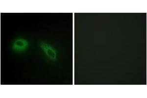 Immunofluorescence (IF) image for anti-Protein Kinase C Substrate 80K-H (PRKCSH) (AA 81-130) antibody (ABIN2889395) (PRKCSH Antikörper  (AA 81-130))