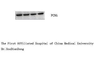 Western Blot (WB) analysis: Please contact us for more details. (PCNA Antikörper)