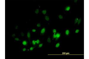 Immunofluorescence of purified MaxPab antibody to BIRC5 on HeLa cell. (Survivin Antikörper  (AA 1-142))