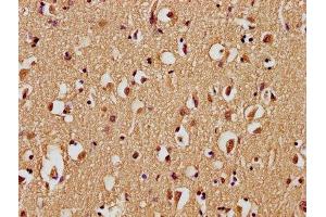 IHC image of ABIN7139743 diluted at 1:100 and staining in paraffin-embedded human brain tissue performed on a Leica BondTM system. (GPR77 Antikörper  (AA 2-19))