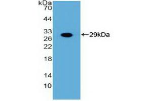 Detection of Recombinant FGFR3, Human using Polyclonal Antibody to Fibroblast Growth Factor Receptor 3 (FGFR3) (FGFR3 Antikörper  (AA 166-375))