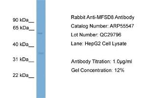 WB Suggested Anti-MFSD8  Antibody Titration: 0. (MFSD8 Antikörper  (Middle Region))