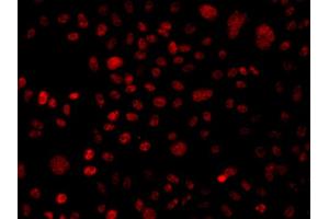 Immunofluorescence analysis of A549 cells using ARID1A antibody.
