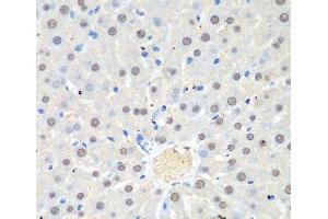 Immunohistochemistry of paraffin-embedded Rat liver using WDR48 Polyclonal Antibody at dilution of 1:100 (40x lens). (WDR48 Antikörper)
