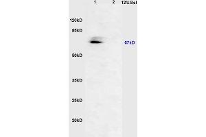 Lane 1: mouse embryo lysates Lane 2: rat brain lysates probed with Anti AVPR2 Polyclonal Antibody, Unconjugated (ABIN713231) at 1:200 in 4 °C. (RUNX2 Antikörper  (pSer451))