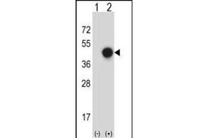 Western blot analysis of X (arrow) using rabbit polyclonal X Antibody (C-term) (ABIN657757 and ABIN2846739). (XPA Antikörper  (C-Term))