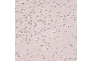 Immunohistochemistry of paraffin-embedded mouse brain using PRPF31 antibody (ABIN6132996, ABIN6146262, ABIN6146264 and ABIN6221399) at dilution of 1:100 (40x lens).