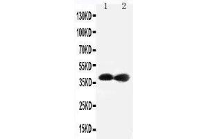 Anti-Cdk7 antibody,  Western blotting Lane 1: Rat Testis Tissue Lysate Lane 2: Rat Ovary Tissue Lysate (CDK7 Antikörper  (C-Term))