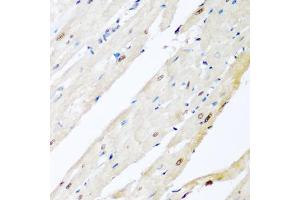 Immunohistochemistry of paraffin-embedded rat heart using VCP antibody (ABIN6290879) at dilution of 1:200 (40x lens).