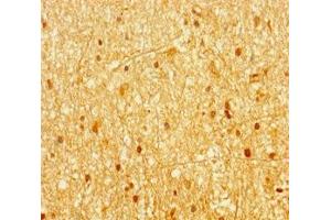 Immunohistochemistry of paraffin-embedded human brain tissue using ABIN7144657 at dilution of 1:100 (Aryl Hydrocarbon Receptor Antikörper  (AA 126-353))