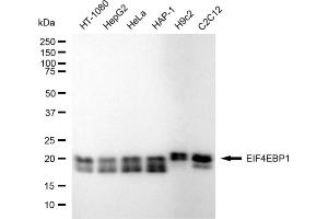 Western blotting analysis using EIF4EBP1 antibody (ABIN7798532). (Rekombinanter eIF4EBP1 Antikörper)