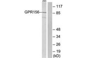 Western blot analysis of extracts from 293 cells, using GPR156 Antibody.