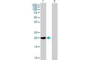 Western Blot analysis of DUSP14 expression in transfected 293T cell line by DUSP14 MaxPab polyclonal antibody. (DUSP14 Antikörper  (AA 1-198))
