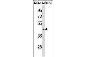 Western blot analysis in MDA-MB453 cell line lysates (35ug/lane). (ALG8 Antikörper  (N-Term))