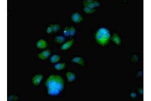 Immunofluorescent analysis of MCF-7 cells using ABIN7152042 at dilution of 1:100 and Alexa Fluor 488-congugated AffiniPure Goat Anti-Rabbit IgG(H+L) (Estrogen Receptor alpha Antikörper  (AA 10-591))