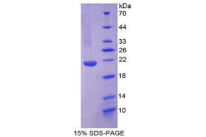 SDS-PAGE (SDS) image for Neuroglobin (NGB) (AA 1-151) protein (His tag) (ABIN1980791) (Neuroglobin Protein (NGB) (AA 1-151) (His tag))
