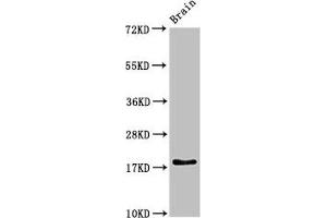 Western Blot Positive WB detected in: Rat brain tissue All lanes: RPL23A antibody at 3 μg/mL Secondary Goat polyclonal to rabbit IgG at 1/50000 dilution Predicted band size: 18 kDa Observed band size: 18 kDa (RPL23A Antikörper  (AA 1-92))