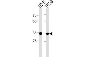 Western Blotting (WB) image for anti-Ribosomal Protein, Large, P0 Pseudogene 6 (RPLP0P6) antibody (ABIN3004613) (RPLP0P6 Antikörper)