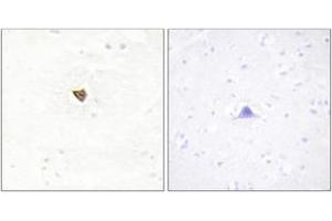 Immunohistochemistry analysis of paraffin-embedded human brain tissue, using JAKMIP2 Antibody.
