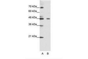 ZNF645 Antikörper  (N-Term)