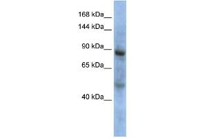 WB Suggested Anti-ZHX3 Antibody Titration: 0. (ZHX3 Antikörper  (Middle Region))