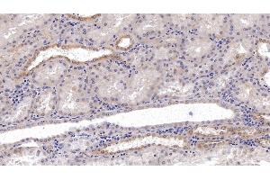 Detection of NCCT in Human Kidney Tissue using Monoclonal Antibody to Na-Cl Cotransporter (NCCT) (SLC12A3 Antikörper  (AA 3-146))