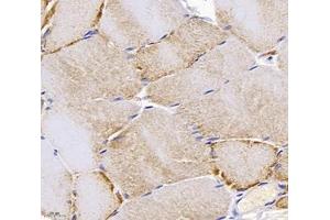 Immunohistochemistry analysis of paraffin-embedded rat skeletal muscle using,PPAPDC3 (ABIN7075036) at dilution of 1: 4000 (PPAPDC3 Antikörper)