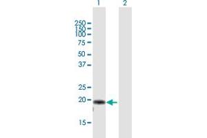 Western Blot analysis of AP3S2 expression in transfected 293T cell line by AP3S2 MaxPab polyclonal antibody. (AP3S2 Antikörper  (AA 1-193))