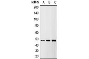 Western blot analysis of DR5 expression in HEK293T (A), A549 (B), H9C2 (C) whole cell lysates. (TNFRSF10B Antikörper  (Center))