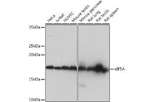 Western blot analysis of extracts of various cell lines, using eIF5A Rabbit mAb (ABIN1682900, ABIN7101685, ABIN7101686 and ABIN7101687) at 1:1000 dilution. (EIF5A Antikörper)