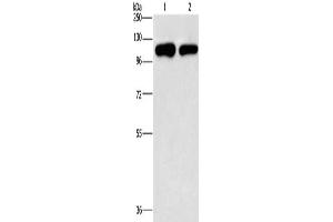 Gel: 10 % SDS-PAGE, Lysate: 40 μg, Lane 1-2: A431 cells, hela cells, Primary antibody: ABIN7191891(PIP5K1C Antibody) at dilution 1/500, Secondary antibody: Goat anti rabbit IgG at 1/8000 dilution, Exposure time: 2 minutes (PIP5K1C Antikörper)