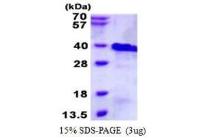 Image no. 1 for Ring Finger Protein 4 (RNF4) protein (His tag) (ABIN1098423) (RNF4 Protein (His tag))