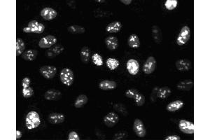 Immunofluorescent staining of HeLa cells. (Ki-67 Antikörper)