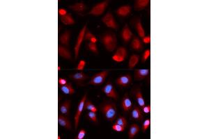 Immunofluorescence (IF) image for anti-Friend Leukemia Virus Integration 1 (FLI1) antibody (ABIN1876845) (FLI1 Antikörper)