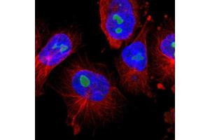 Immunofluorescent staining of human cell line U-251 MG with TNFAIP1 polyclonal antibody  shows positivity in nucleoli. (TNFAIP1 Antikörper  (AA 80-170))