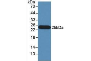 IFNB1 Antikörper